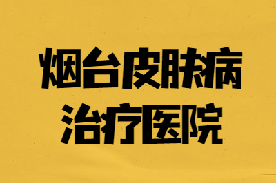 烟台什么是银屑病症状 银屑病是不是可以治疗好的