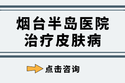 烟台皮肤病医院的治疗好不好-银屑病会有什么特征