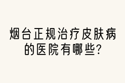 烟台皮肤病医院治疗银屑病哪些要注意