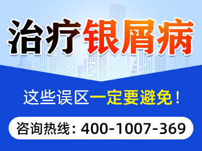 母亲牛皮癣会遗传下一代吗_长牛皮癣会遗传给下一代么