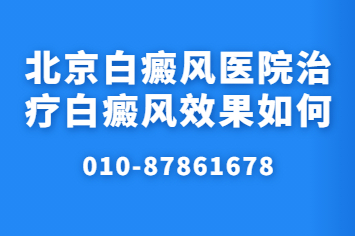 北京卫人医院能去吗 白癜风患者常见的误区有哪些?