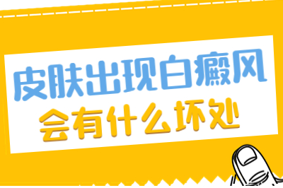 烟台什么医院看白点癜风好-白斑导致生活上的哪些影响