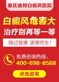 重庆专业的白癜风医院 治疗白癜风要注意什么?