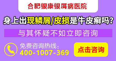 银屑病严重会怎样_银屑病严重还是银屑病严重