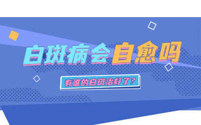 烟台专治白癜风的医生 稳定期的十几年白斑会扩散吗