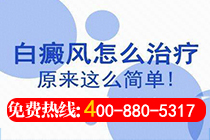 治疗白癜风医院排名公布 治疗白癜风正规医院—白癜风难以恢复的原因有哪些