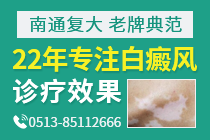 南京哪里医院可以看好白癜风-夏天白癜风患者洗澡时要注意些什么呢