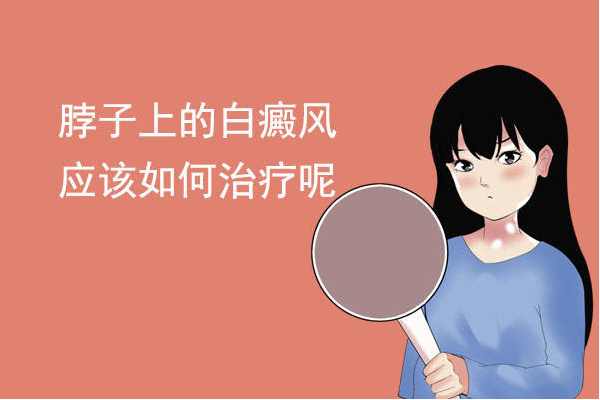 烟台正规白癜风医院 烟台白癜风医院好不好