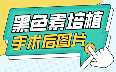 排名宣布 郑州白癜风专科医院有哪些 小面积白癜风白斑能治吗