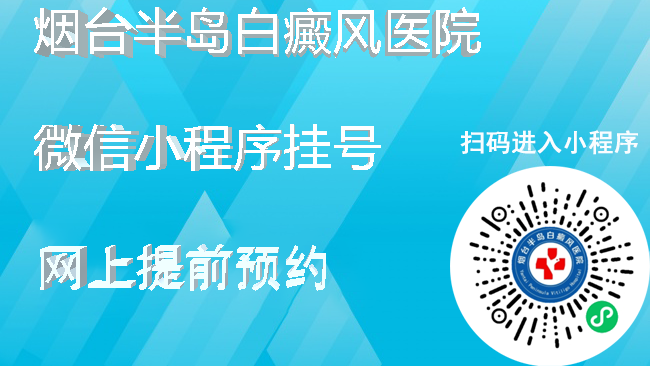 威海看白癜风的医院 威海好的白癜风医院