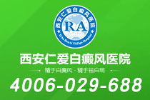 白癜风专栏 西安白癜风医院 家长应该怎样应对儿童白癜风的治疗