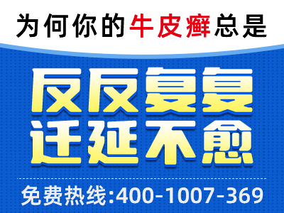 合肥银屑病银康银屑病口碑_合肥银康银屑病医院官网