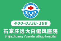 石家庄治疗白癜风口碑好的医院-得了白癜风后该要如何护理呢