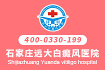 石家庄治白癜风专科去哪家医院好-脸上出现了白癜风该要怎么护理