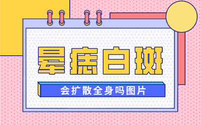 烟台治疗白斑哪里好-烟台去哪里治疗白癜风好
