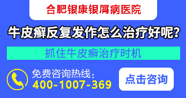 合肥银康银屑病医院乱收费吗