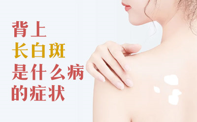 半岛白斑医院复色帮扶“帮益帮”-烟台看白癜风医院前五