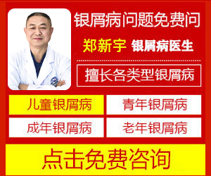 合肥银康银屑病医院治疗费用咋样