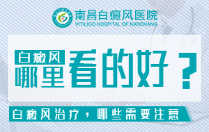 「12月排名公布」南昌哪家医院可以看白癜风，生活中有哪些因素会导致男性白癜风?