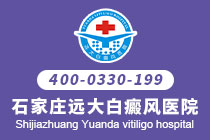 邢台哪个医院治疗小孩白癜风好-脚上长了白癜风后该怎样治疗