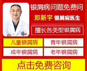 银屑病怀孕了擦什么药膏