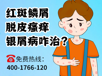 河南哪个医院治疗银屑病療效较好_河南哪有治疗牛皮癣的中医