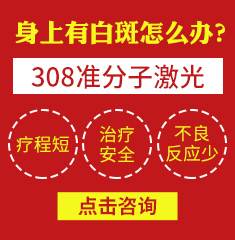 广州哪个医院专业治疗白癜风-白癜风饮食注意事项有哪些