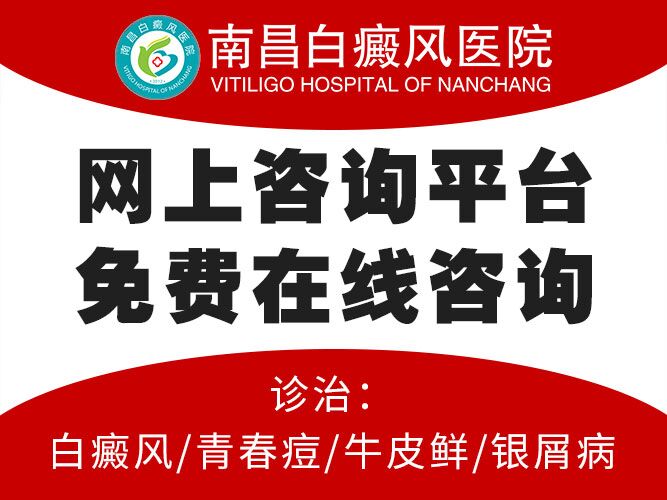 重要通告：江西白癜风科医院前五具体排名，谨防白癜风的春季复发?