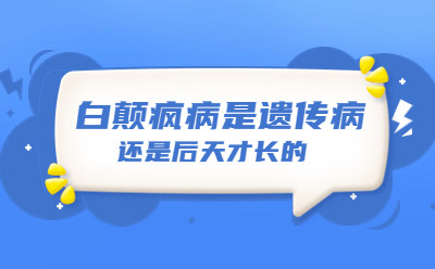 患者推荐！兰州中研白癜风医院联系方式（预约挂号）白点癫风可以不治疗吗？