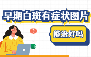 热点榜单！兰州中研白斑医院top前三（榜单公开）白癜风可以治吗