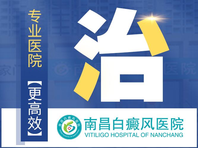 热门公布："江西"白癜风十大医院白癜风医院排行榜公布，哪种类型的白癜风发展得更快?