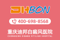排名公布！重庆白癜风专科医院哪个好-手部的白癜风是由什么引起的