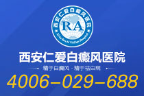 本月热搜：西安市白癜风医院“排名前十”-脖子上的白点癫风应该怎么治疗？