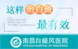 紧急发布！南昌白癜风专病专治医院名单正式公布，白癜风怎样饮食比较合理？