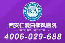 现象追踪！西安专治白癜风的医院有哪些"类型辨析"色素痣和白癜风的区别