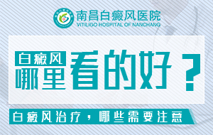 南昌什么医院治疗白癜风好-“南昌市”治疗白癜风医院2026新推荐！