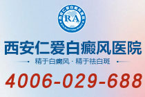 排行公开!西安专治白癜风医院"具体排名"如何判断老年白癜风